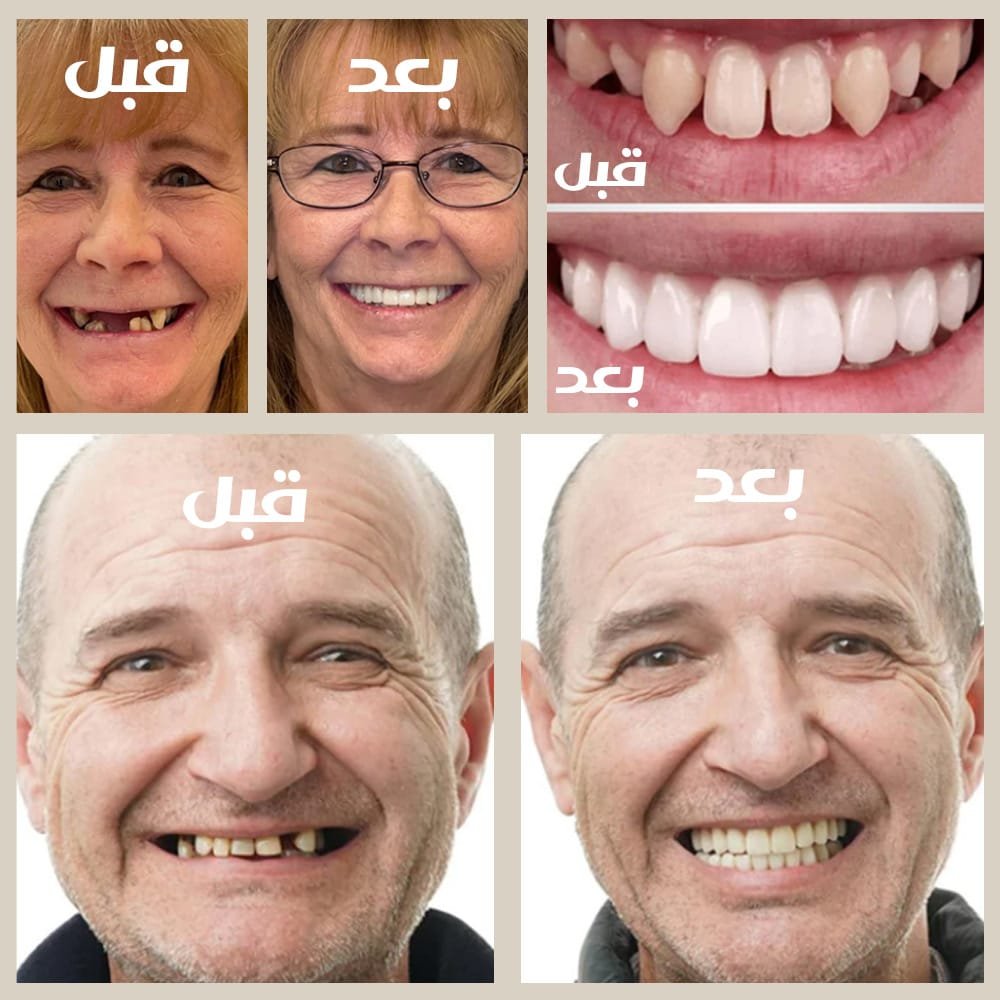 طقم اسنان متحرك 3 3 1